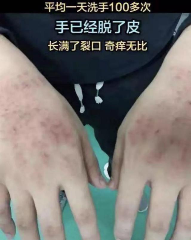 心疼！致敬前方的你